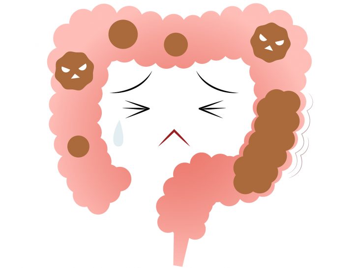 便秘の腸